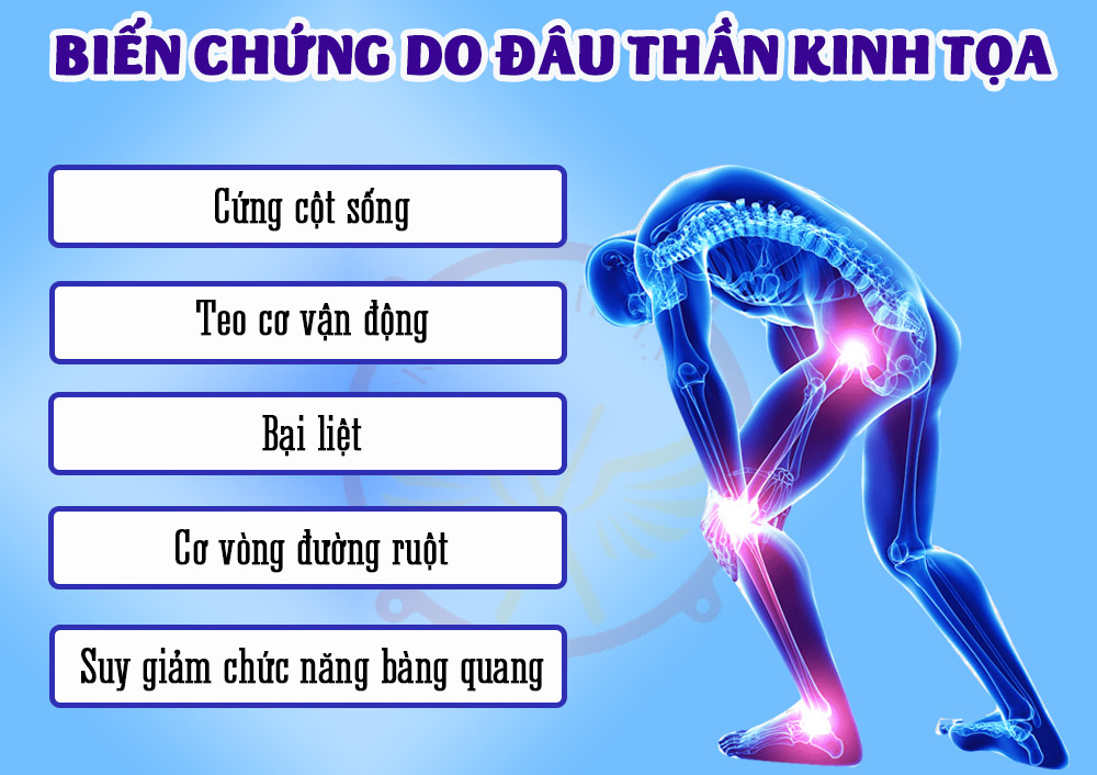 Đau thần kinh tọa có nguy hiểm không